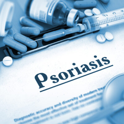 6 Health Conditions Linked to Psoriasis and Treatment Options