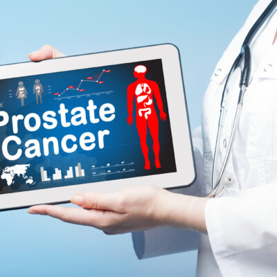 4 Early Symptoms of Prostate Cancer