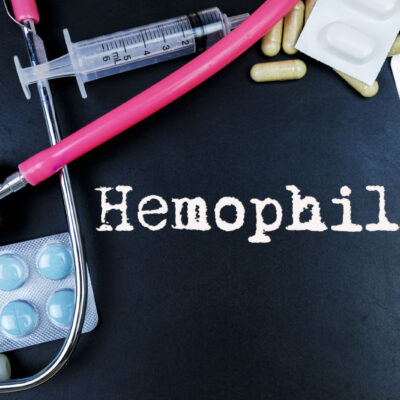 5 Common Symptoms of Hemophilia