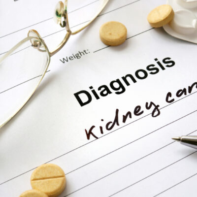 Early Symptoms of Kidney Cancer